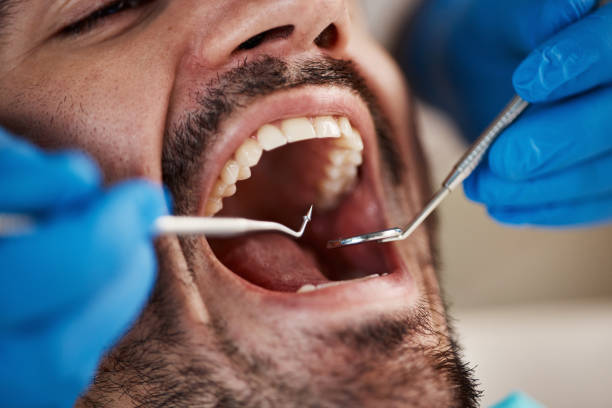 Best Pediatric Emergency Dentist in Limestone Creek, FL